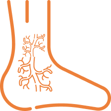 Peripheral vascular disease